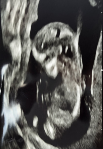 Due late Oct 🎃 - early Nov 🎉