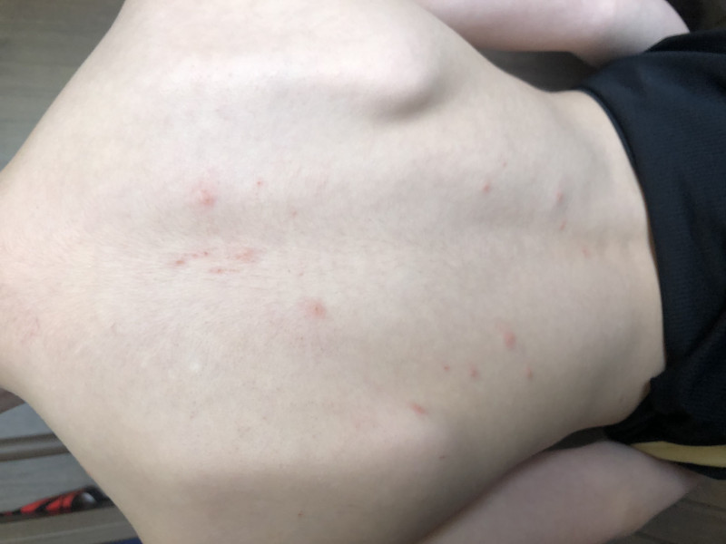 Any ideas what this spotty rash is please?