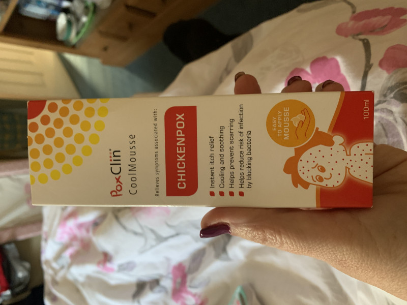 Chickenpox 
