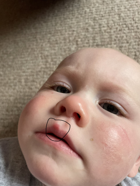 Strange spot on DS’ lip