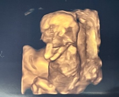 Due September 2022 (Thread 5!)