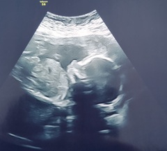 Due September 2022 (Thread 6!)