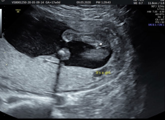 Definitely a boy?