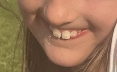 Any dentists? Pic included!