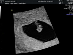 Due December (thread 2) 👯