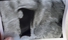 BFPs following IVF to take symptoms & scans