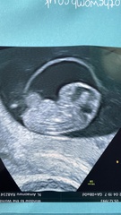 👶 Due November 2022 - part II 🎆