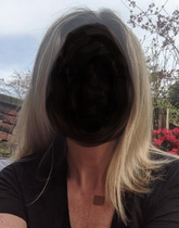 Awful post chemo hair. Desperate to improve it.