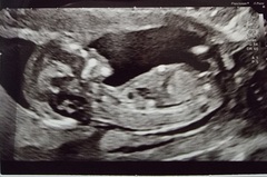 Is Nub Theory Accurate? Was it right for you?