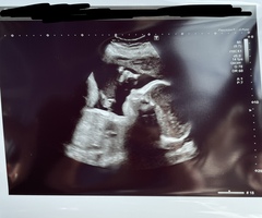 Due June 2022 Thread Nine