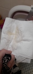 Is it mucus plug?