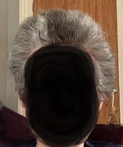 Awful post chemo hair. Desperate to improve it.