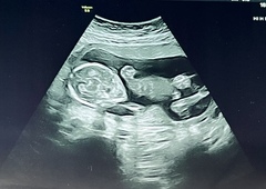 Due September 2022 (Thread 5!)