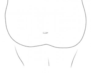 How do I dress my big post C-section body?