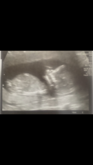 Sex guesses please!