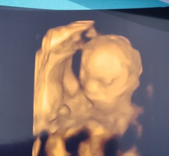 Due September 2022 (Thread 6!)