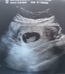 👶 Due November 2022 - part II 🎆