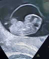 👶 Due November 2022 - part II 🎆