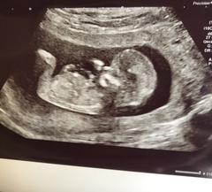 Any guesses on the gender of my baby?