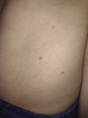 What are these?