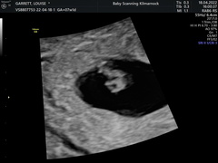 Due December (thread 2) 👯