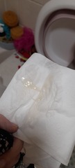 Is it mucus plug?