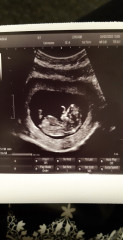 Boy or girl?