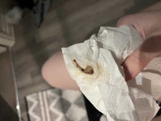 TTC implantation TW Graphic Image help please! 