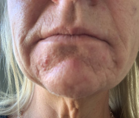 Can aesthetics help this (pics)