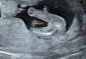 Did they tell us the wrong gender?