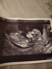 Boy or girl? 