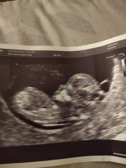 Boy or girl? 