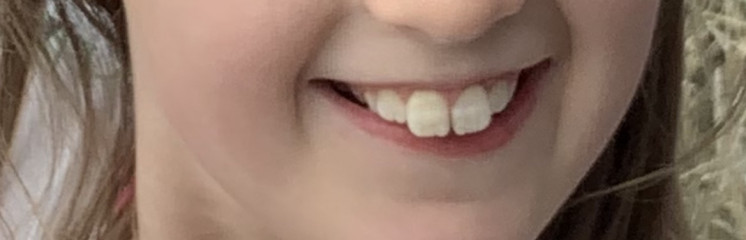 Any dentists? Pic included!