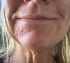 Can aesthetics help this (pics)
