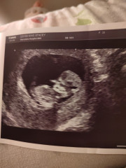 Boy or girl? 