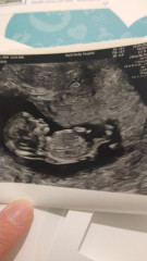 Gender guesses