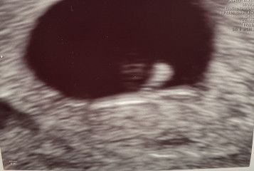 Due December '22 thread 2!