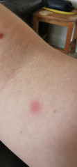 What's biting me 😭😭