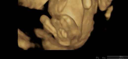 Definitely a boy?