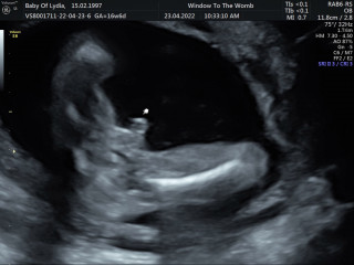 Definitely a boy?