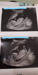 Boy or girl?