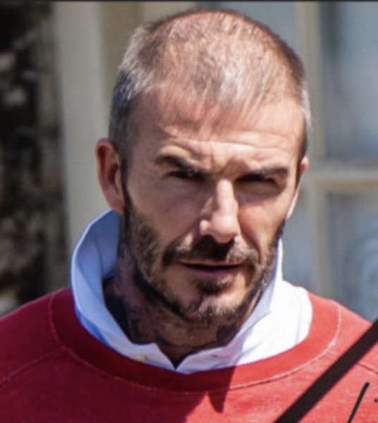 Has David Beckham had work done?