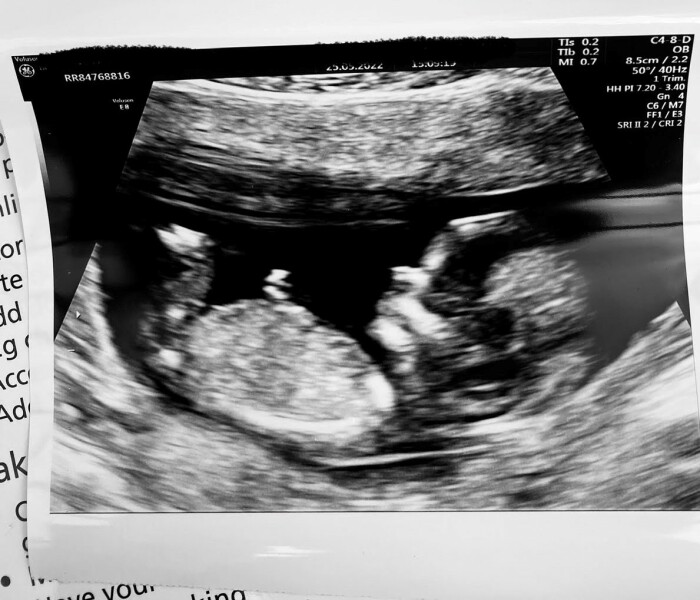 Due December '22 thread 2!