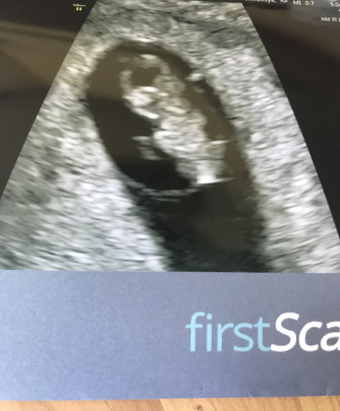 Due December '22 thread 2!