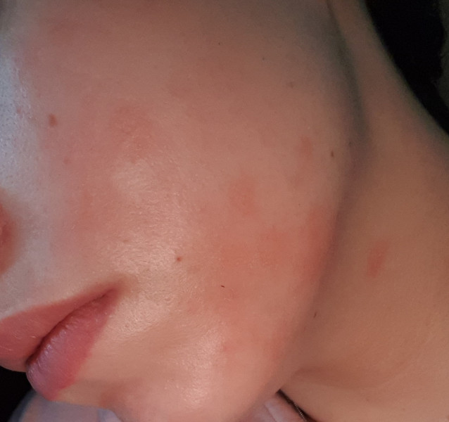 Our Dermatica journey