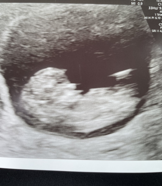 Navigating pregnancy after loss thread 2