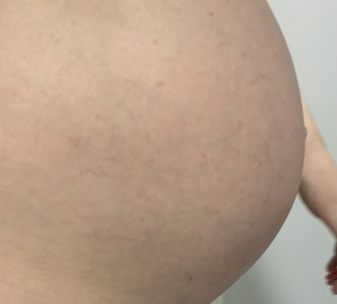 Red spots on bump- not itchy 