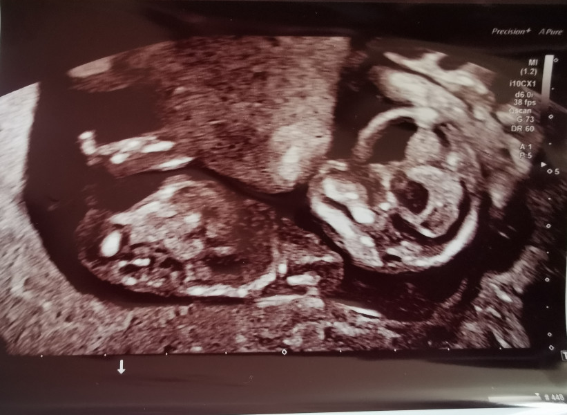 Gender guesses please!!