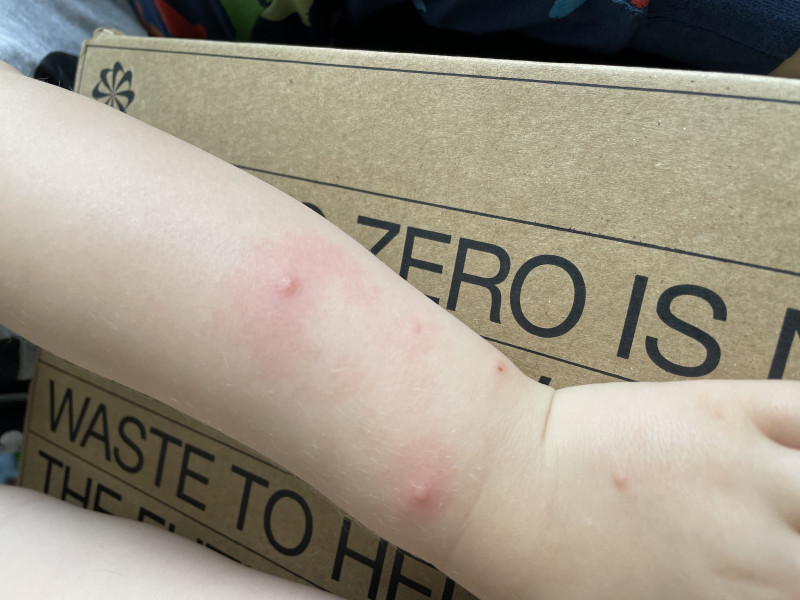 What are these spots?? 