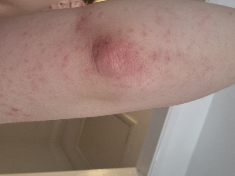 Skin issues, any ideas??